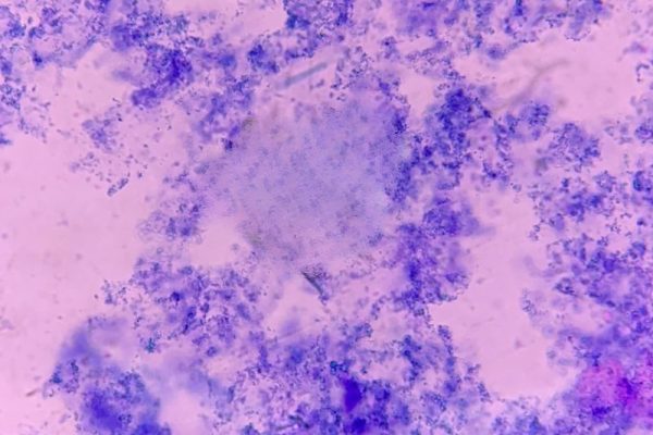 1 cepas microbianas en microscopio