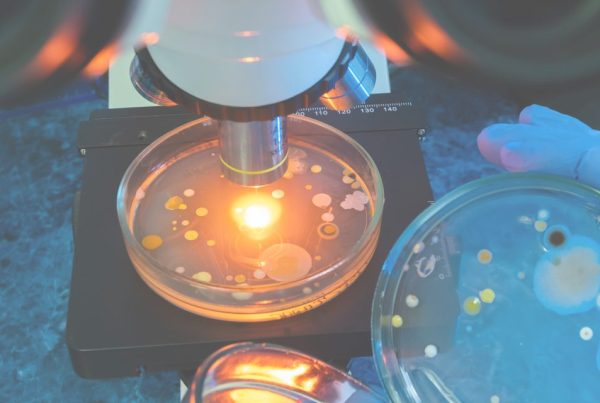 cepas microbianas en un microscopio